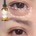 Top Eye Hydrating Oil for Reducing Dark Circles and Soothing Sensitive Skin Top Eye Hydrating Oil for Reducing Dark Circles and Soothing Sensitive Skin