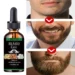 Top Hydrating Beard Oil for Men to Soften, Strengthen, and Control Beard Hair