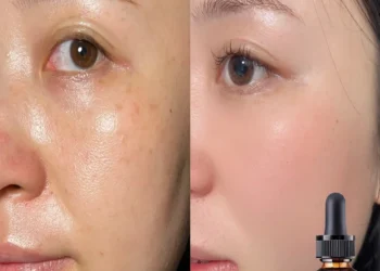 Discover the Best Hydrating Facial Oil for Sensitive Skin and Radiant Glow