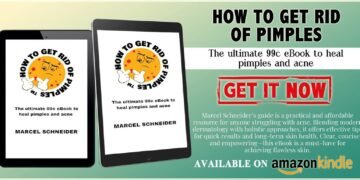 🔬 Professional Advice: Say Goodbye to Pesky Pimples! 🔬   